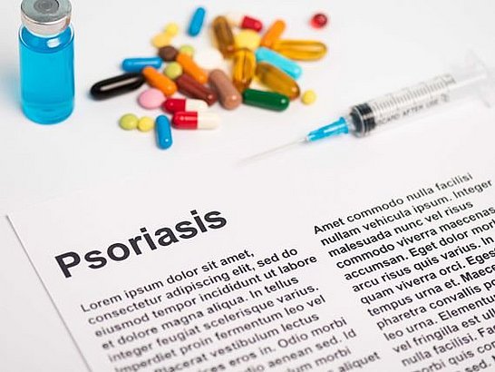 ¿La psoriasis tiene cura? 