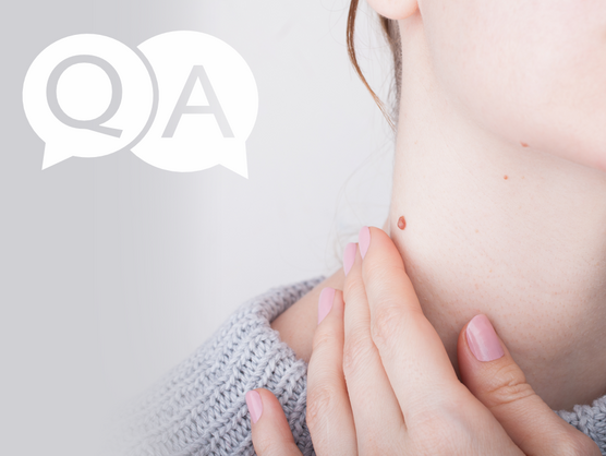 Preguntas y Respuestas sobre sobre verrugas