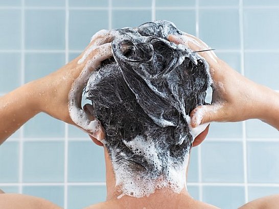 Psoriasis en el Cuero Cabelludo: Tratamientos Efectivos