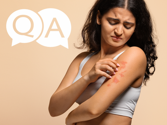 Preguntas y respuestas sobre dermatitis atópica