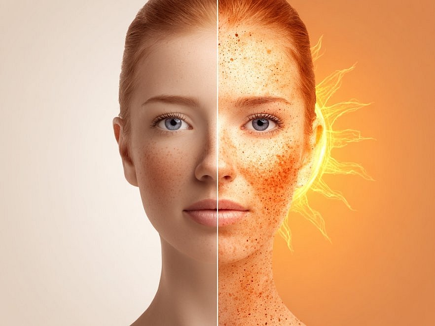 ¿Cómo afecta el sol a la piel? ¿Cómo afecta el sol a la piel?