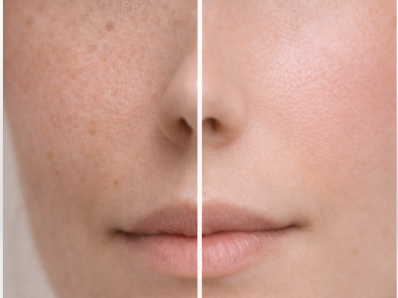 Comparación visual de piel antes y después del uso de retinol: una mitad con textura irregular y otra más lisa y luminosa