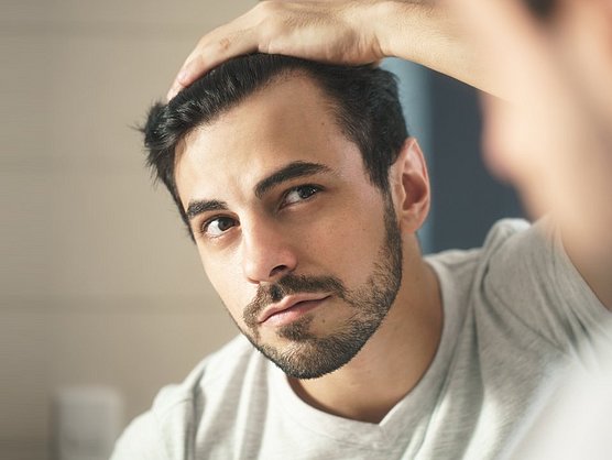 Afrontando la Alopecia: Consejos y Apoyo