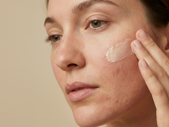 Mujer aplicándose una crema hidratante. Su piel muestra texturas reales, con ligeros signos de irritación, enrojecimiento y poros visibles, representando una barrera cutánea sensible